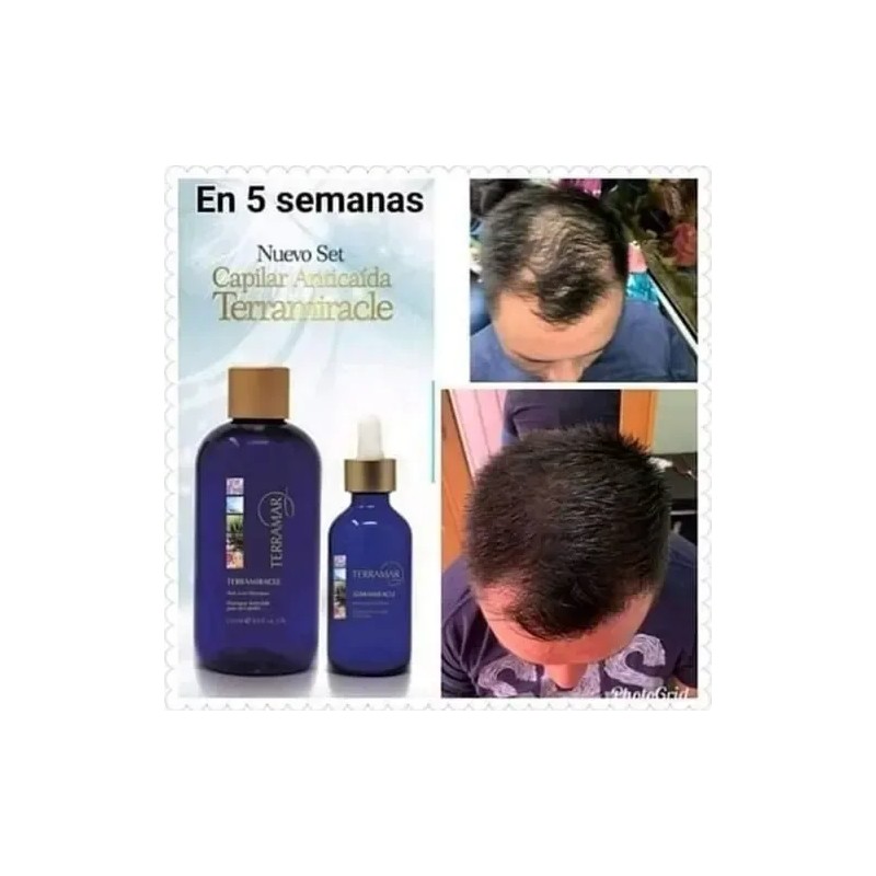 Set Anti Caída Shampoo Y Tratamiento Terramar + Gel