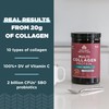 Ancient Nutrition Collagen Powder Protein, Multi Collagen Protein Powder Joint