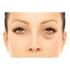 Sheló Nabel Corrector Profesional Elimina Ojeras Manchas Por Sol Sheló