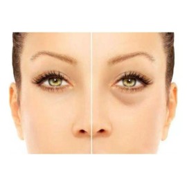 Sheló Nabel Corrector Profesional Elimina Ojeras Manchas Por Sol Sheló Tono Claro