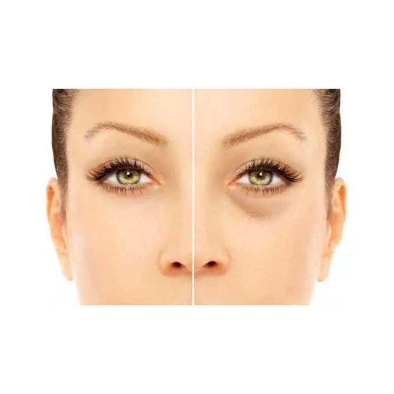Sheló Nabel Corrector Profesional Elimina Ojeras Manchas Por Sol Sheló