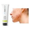 Gel Limpiador Anti Acné Mary Kay Disminuye Brotes Clearproof