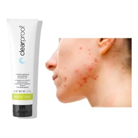 Gel Limpiador Anti Acné Mary Kay Disminuye Brotes Clearproof