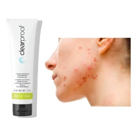 Gel Limpiador Anti Acné Mary Kay Disminuye Brotes Clearproof