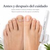 Lapiz Restaurador de Uñas 4 ml para Uñas Quebradizas, Cuidado
