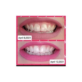 Farmasi Whitening Pasta de Dientes 112g