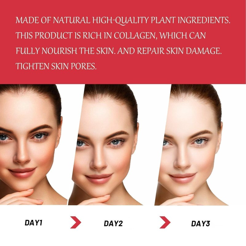Crema Aclaradora de Partes Intimas de Axilas, Crema para Manchas