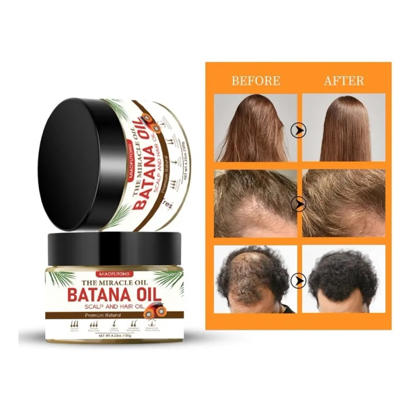Batana Oil Shampoo Bar 3 Em 1: Crescimento Capilar, Queda