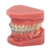 Dental Orthodontic Model 28pcs Teeth Resin Dental Teaching Teeth Model