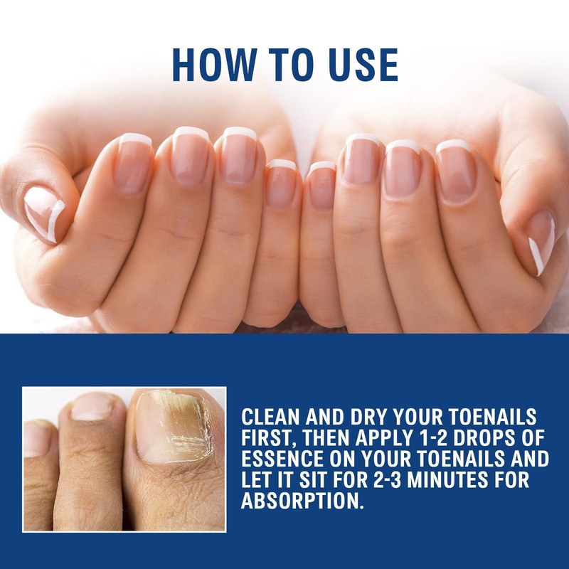 20ml Nail Treatment,Nail Treatment for Toenail Fingernails,Toenai-ls Extra Strong N-ail