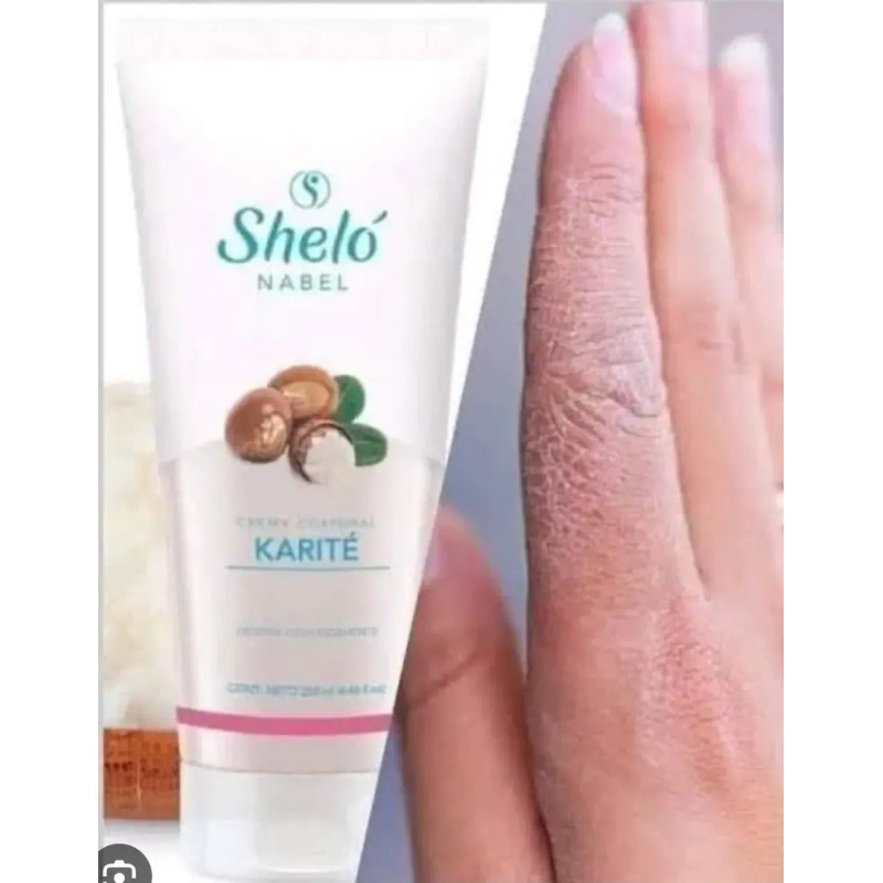 Quítate Resequedad Piel Shelo Nabel