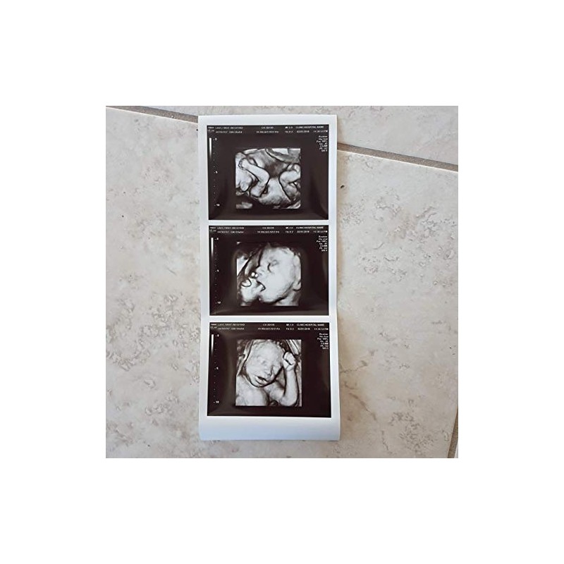 Prank 3D Customized Fake Ultrasound Strip of 3 Photos