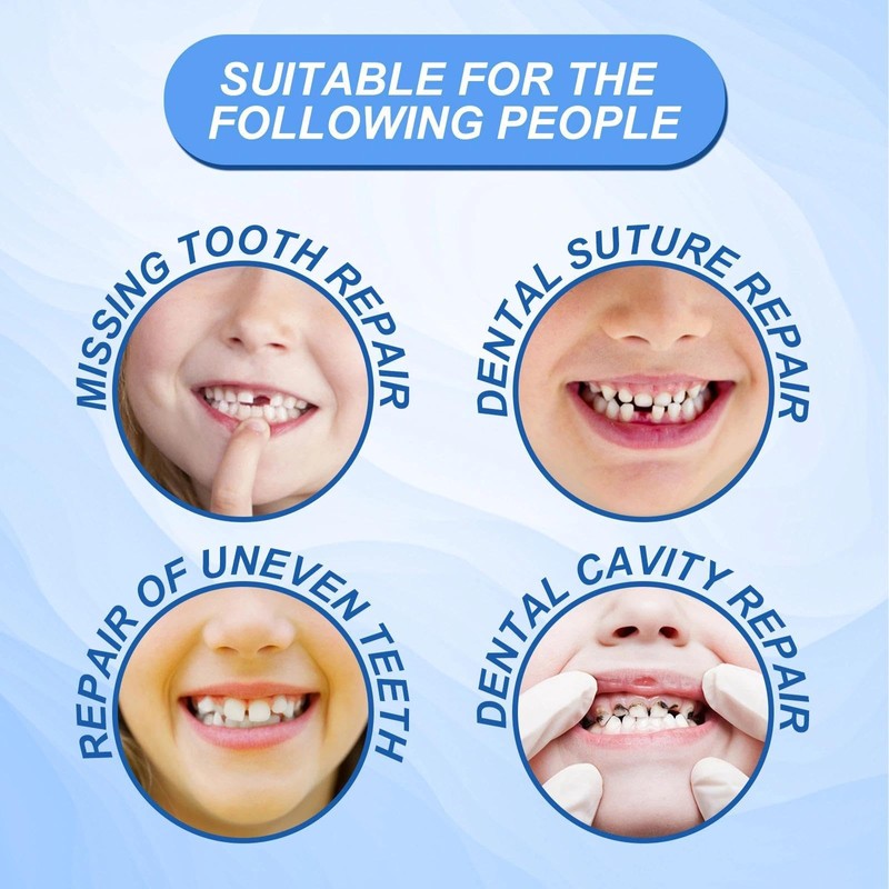 Temporary Tooth Filling Repair Kit – Emergency Dental Repair for