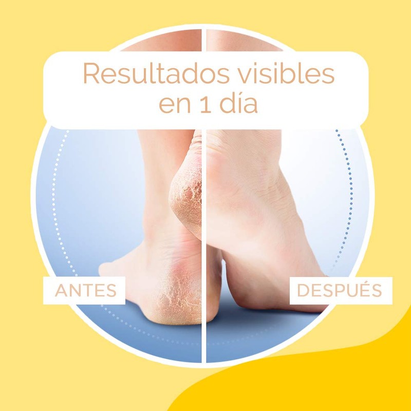 Sch oll Foot Cream for Cracked Heels with Urea and