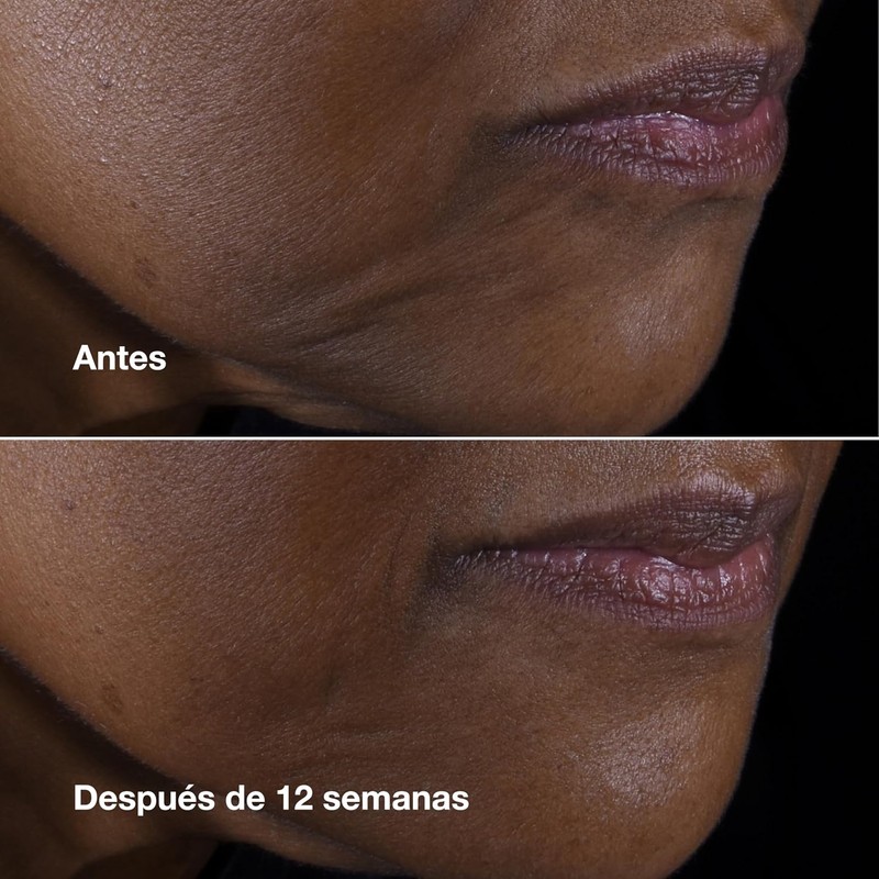 Smart Clinical Repair Lifting Face + Neck Cream Crema Anti