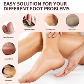 BALUCA Glass Foot File Callus Remover for Feet - Nano Glass Foot Scraper Scrubber Dead Skin Removal for Cracked Heels,Professional Pedicure Tool for Home, Salon, and Travel - Apricot