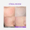 Ampolleta Meoru Podo Vita C Dark Spot Ampoule de Sungboon