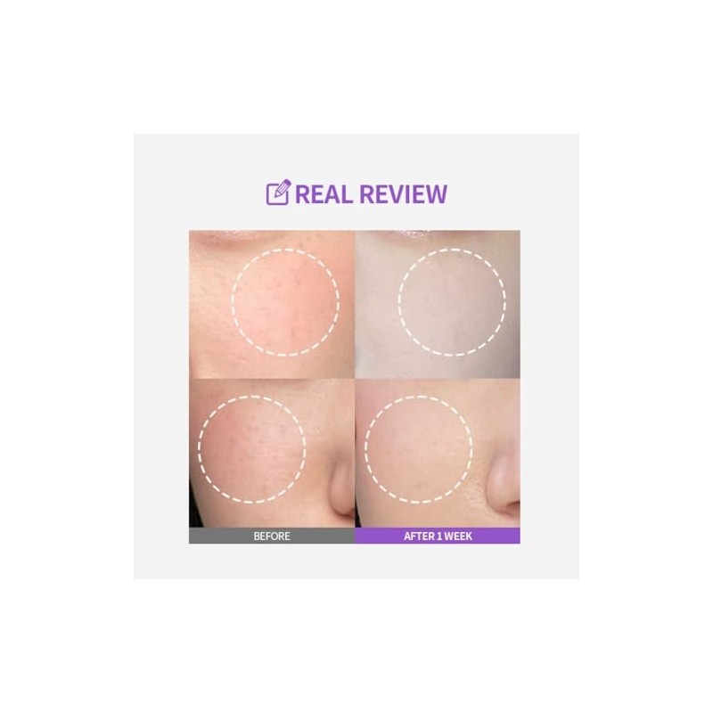 Ampolleta Meoru Podo Vita C Dark Spot Ampoule de Sungboon