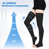 Wegitcs 2Pair 20-30mmHg Compression Stockings for Women, Open-Toe Thigh High