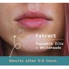 Anva Korean Spot Patches with Salicylic Acid - Ultra-thin Blemish