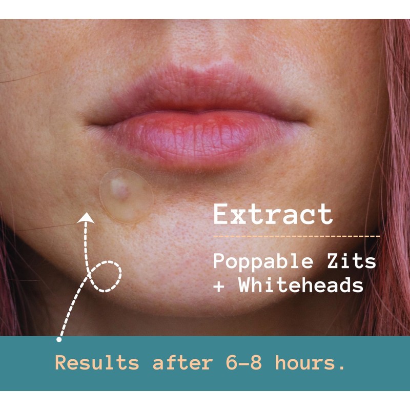 Anva Korean Spot Patches with Salicylic Acid - Ultra-thin Blemish