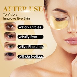 VESPRO 120 PCS 24K Gold Under Eye Patches for Dark Circles and Puffy Eyes, Eye Mask With Collagen and Hyaluronic Acid for Dark Circles, Puffiness and Wrinkles, Eye Skin Care for Women