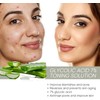 Tónico Ácido Glicólico 7% Exfoliante Hidratante