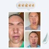 Tratamiento Desmanchador Quita Mancha Trio Paño Acne Melasma