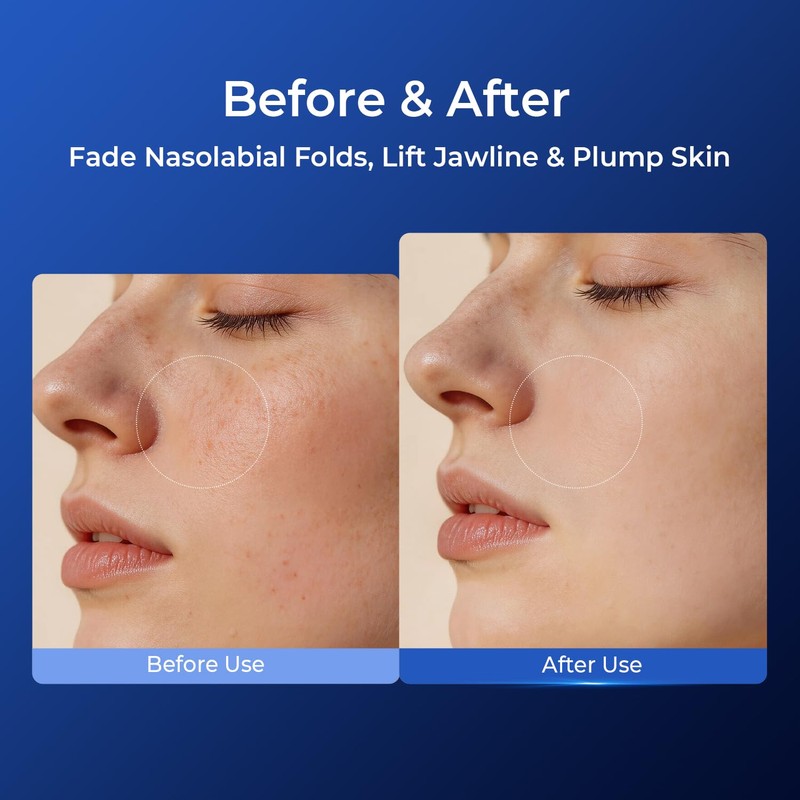 PROFLING Hyaluronic Acid Toner, Deep Hydrating & Moisturizing Facial Toner