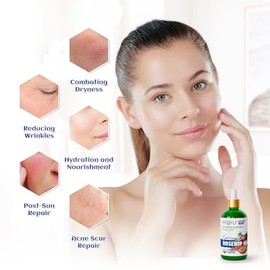 HIQILI Aceite Orgánico De Semilla De Rosa Mosqueta Para El Rostro 100% Puro Y Natural Prensado En Frío Aceite Portador Para Piel Cabello Y Uñas Para M