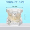 Willoghsa Disease Tooth Model, Dental Typodonte Implant Dental Model with
