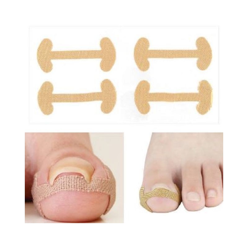 Roycecoqtu 50 Sheets of Ingrown Toenail Protection Band