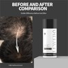 LEWEDO Hair Building Fibers - Instant Volume for Thinning Hair,