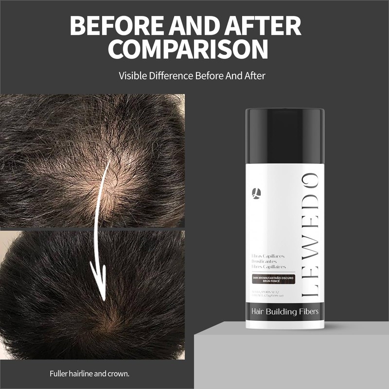 LEWEDO Hair Building Fibers - Instant Volume for Thinning Hair,