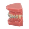 Dental Orthodontic Model 28pcs Teeth Resin Dental Teaching Teeth Model