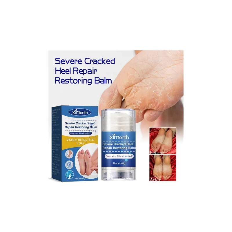 2×crema Reparadora Grietas Secas Y Talones For Pies Y Mano