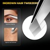 YGQQOY Professional Blackhead Remover Tools,Pimple Popper Tool Kit,Blemish, Whitehead Popping,