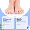60% Urea Cream - Callus Remover Cream, Urea Foot Cream