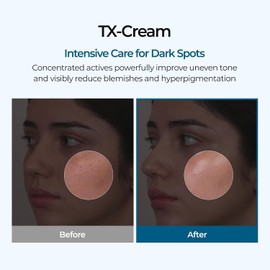 DR.Melaxin Tx Tranexamic Acid Cream Skin Freckle Cream, Blemishes, Anti-pigmetation Korean Skin Care Korean Cosmetics 1.7 Fl OZ (50 Ml)