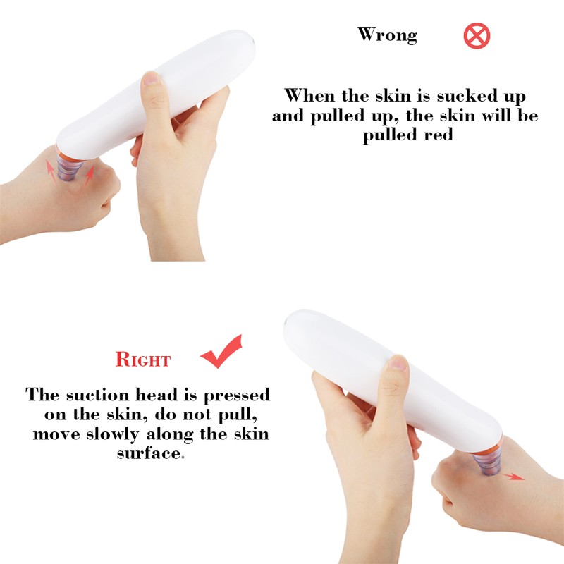 Vacuum Blackhead Suction Acne Removal Electric Pore Cleaner Skin Care