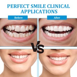 1 Pair Clip in Veneers Teeth,Dentures False Teeth,Snap on Veneers Teeth Top and Bottom,Temporary Upper and Lower False Teeth for Men Women with Bad Teeth