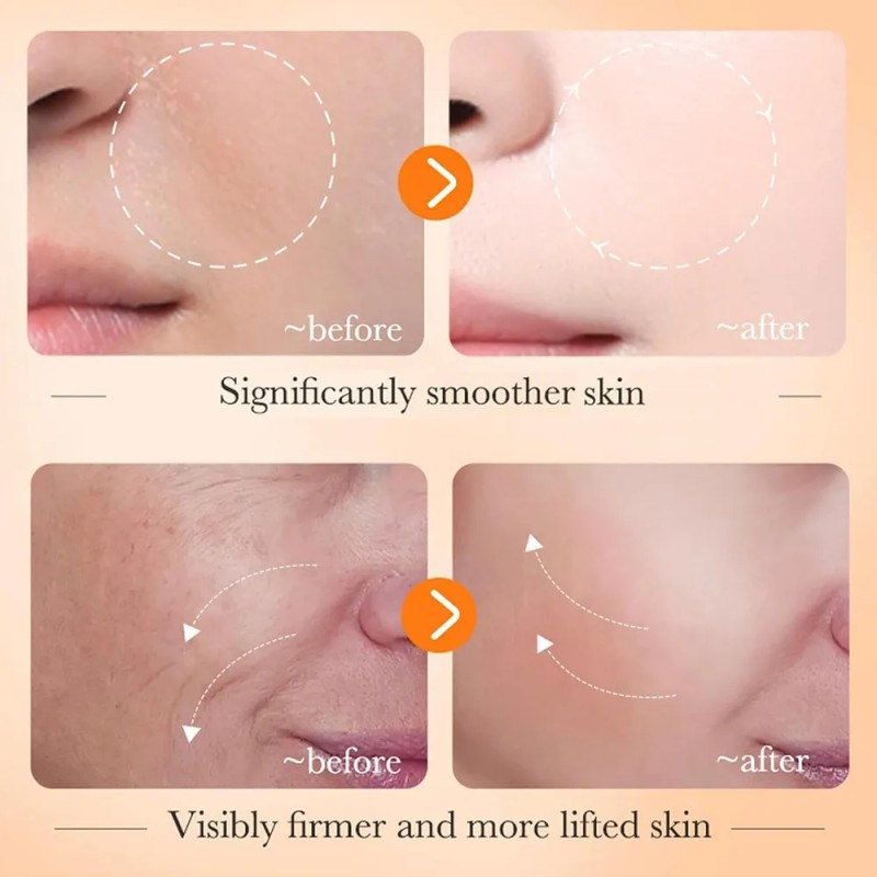 Crema Serum Despigmentante Vitamina C Paño Manchas Aclara Todo Tipo