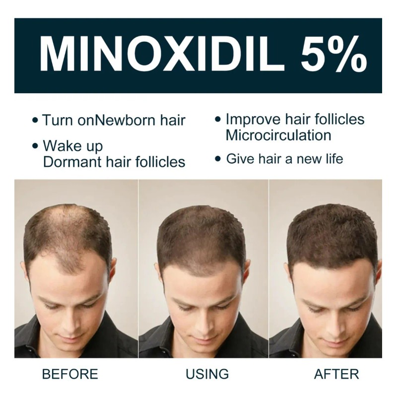 Tratamiento Para Cabello Y Barba Para El Crecimiento Del Cab