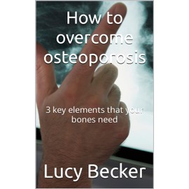  How to overcome osteoporosis: 3 key elements that your bones need