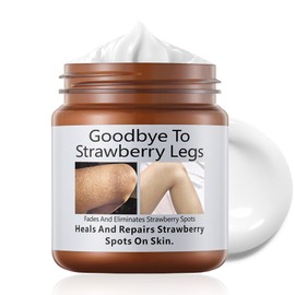 Strawberry Legs Treatment Cream, Keratosis Pilaris Treatment, Anti Winkle Smoothing Face Body Moisturiser, Deep Nourishment Skin Exfoliating Repair Cream Fades Strawberry Skin,120g