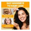 Fortalece Las Raíces Del Cabello Alpha Infuse Advanced /