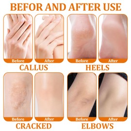 3 Bottles Honey Foot Cream, Heel Balm for Cracked, Heel Cream for Deep Cracked Skin, Strong Moisturizing and Repairing, for Daily Skin Care for the Whole Body (40g*3)