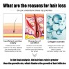 Sérum Para Engrosar El Cabello Para Hombres Y Crecimiento De