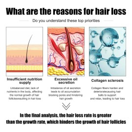 Sérum Para Engrosar El Cabello Para Hombres Y Crecimiento De