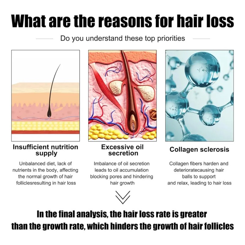 Sérum Para Engrosar El Cabello Para Hombres Y Crecimiento De